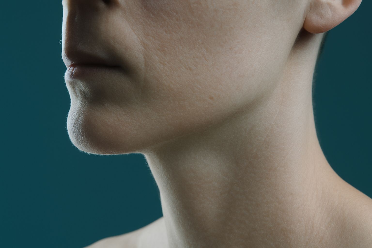 Radiofrequency Microneedling in London, editorial image